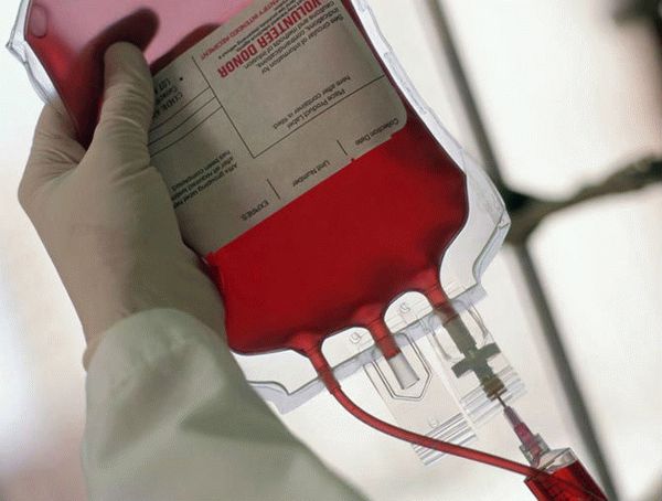 Rh (-) и Rh (+) положительные группы крови одинаково подходят, в то время как Rh отрицательные люди должны получать только переливание крови того же типа.